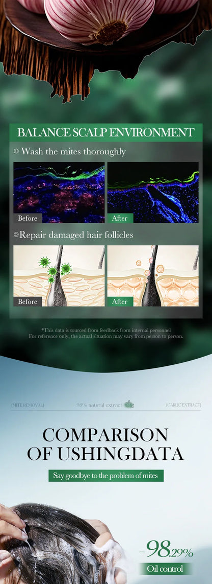 Garlic Anti-Mite Shampoo - Deep cleansing scalp care, specially designed for dandruff and itchy scalps.