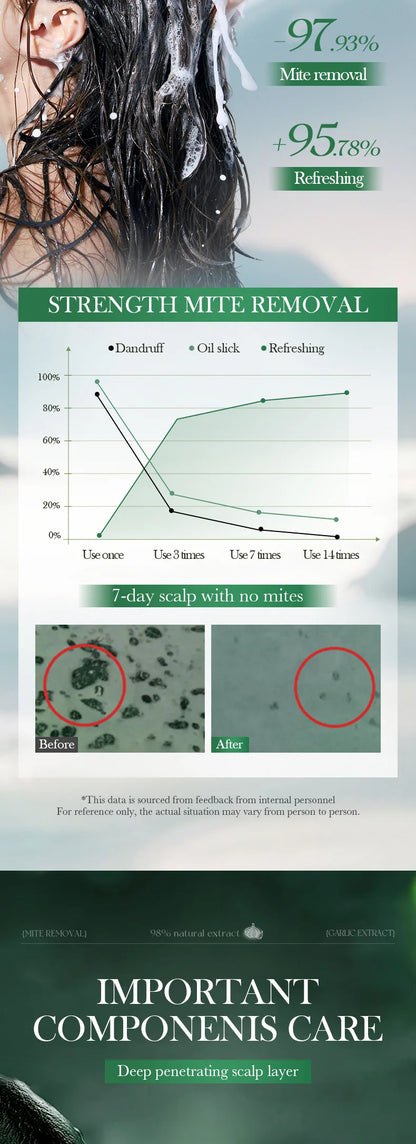 Garlic Anti-Mite Shampoo - Deep cleansing scalp care, specially designed for dandruff and itchy scalps.